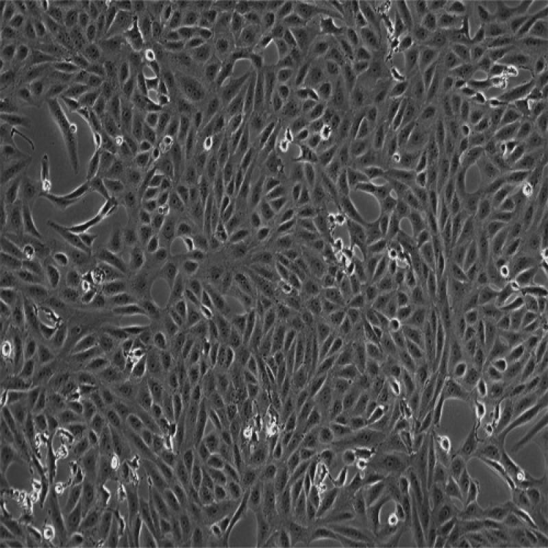 非洲绿猴胚胎肾细胞(MARC145)