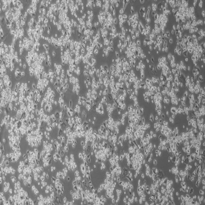 小鼠脑神经瘤细胞 （Neuro-2a（N2A））