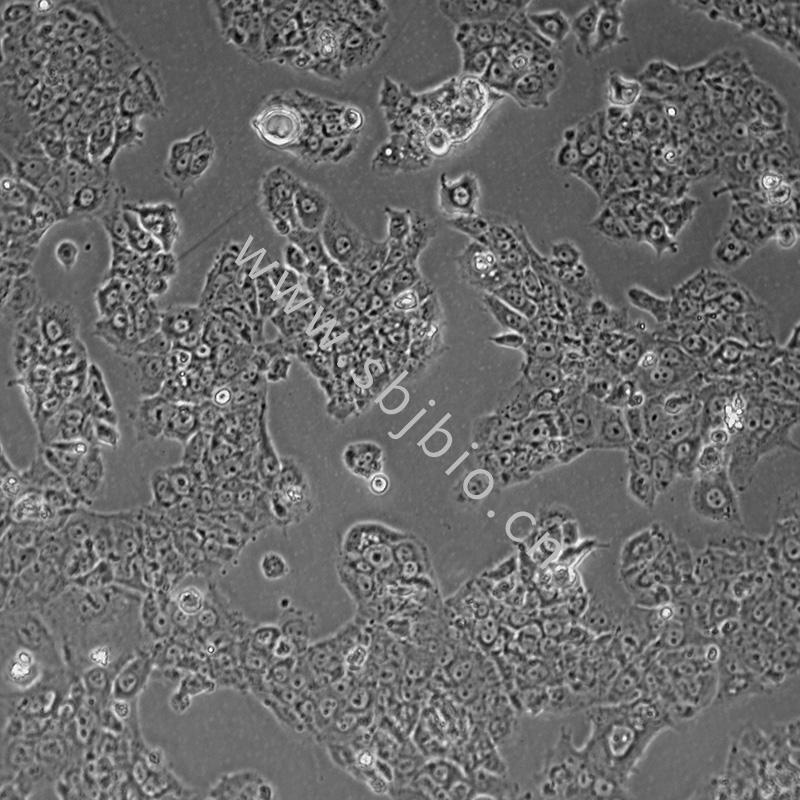 人绒毛膜肿瘤细胞（Bewo）