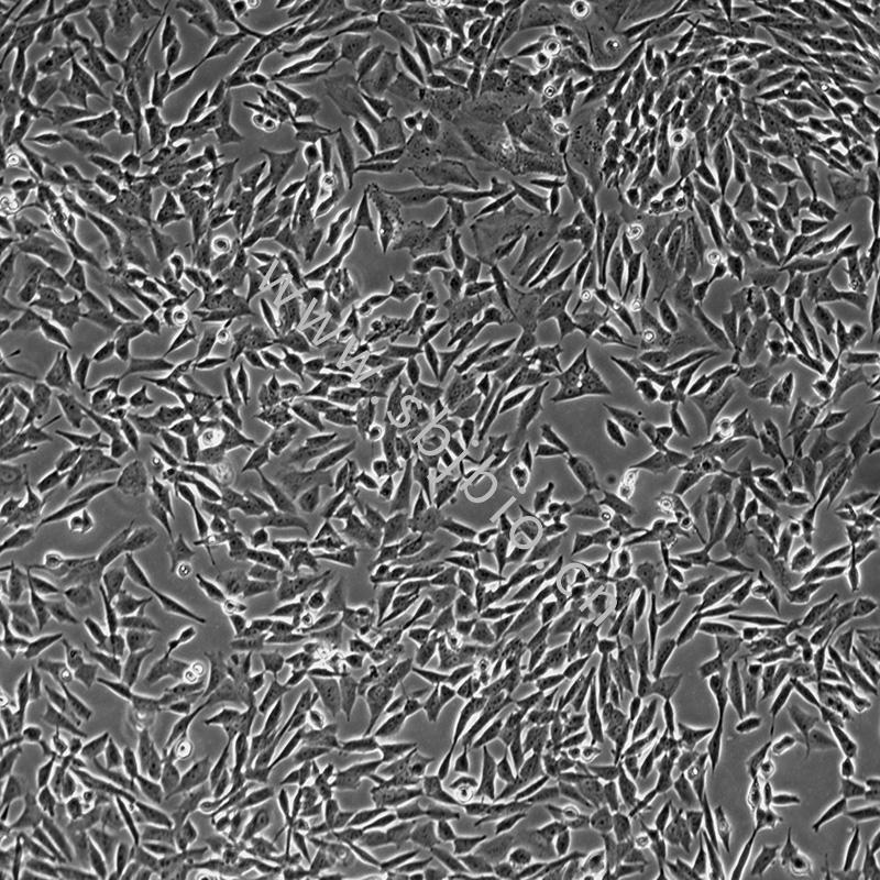 人神经母细胞瘤细胞（SH-SY5Y）