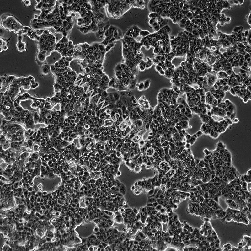 人乳腺癌细胞（MCF7）