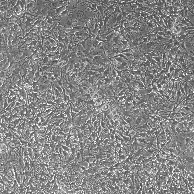 人肝癌细胞（HUH-7）