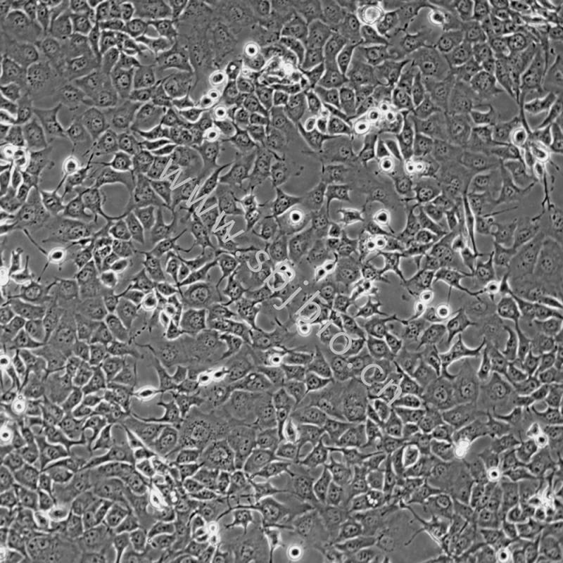 人肺腺癌细胞（NCI-H1975）