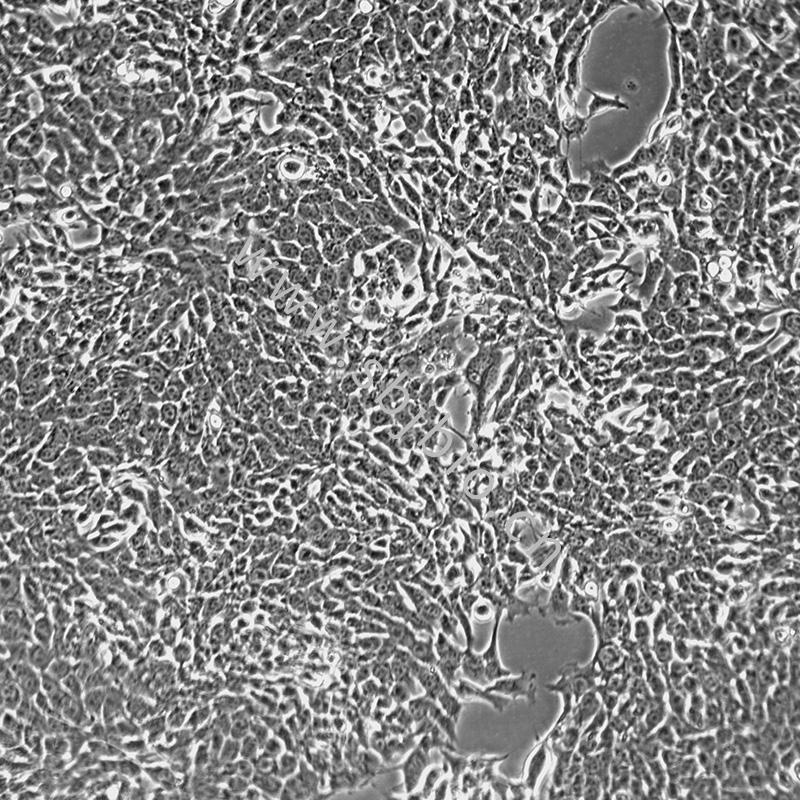 小鼠乳腺癌细胞(4T1)