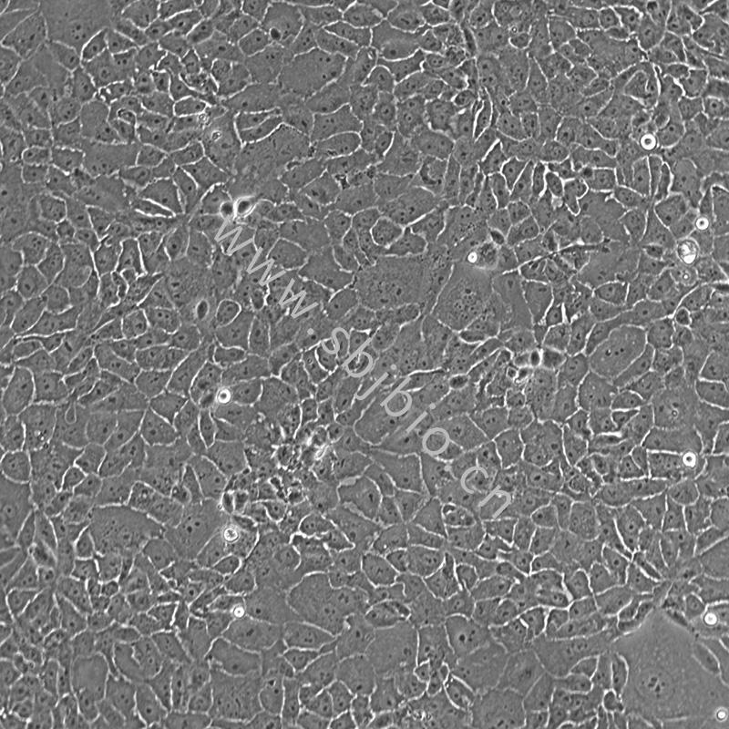 人胆管癌细胞 HuCC-T1 