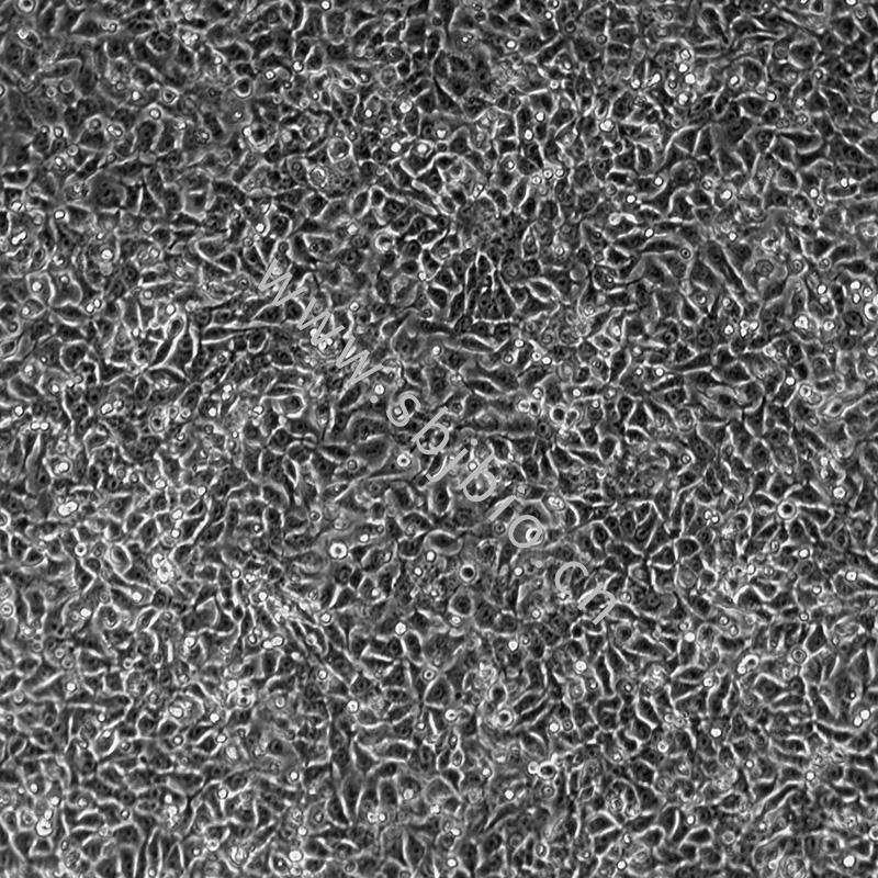 人肺癌细胞(淋巴结转移)NCI-H292