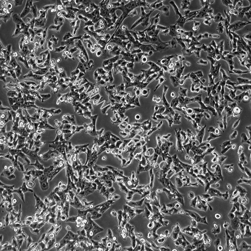 小鼠肝癌细胞(HEPA1-6)