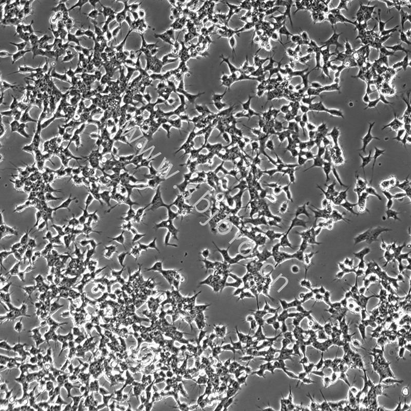 人鼻咽癌细胞 C666-1
