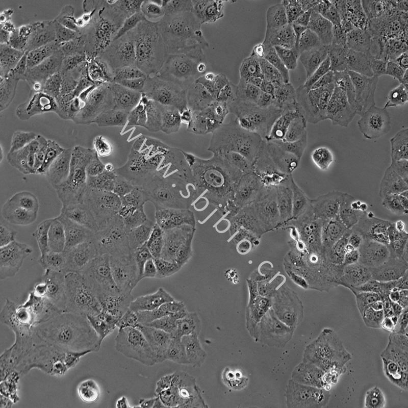 人肝癌亚力山大细胞 PLC-P...
