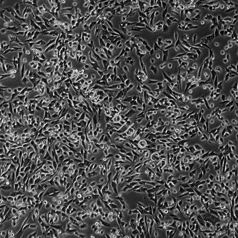 小鼠前列腺癌细胞RM-1