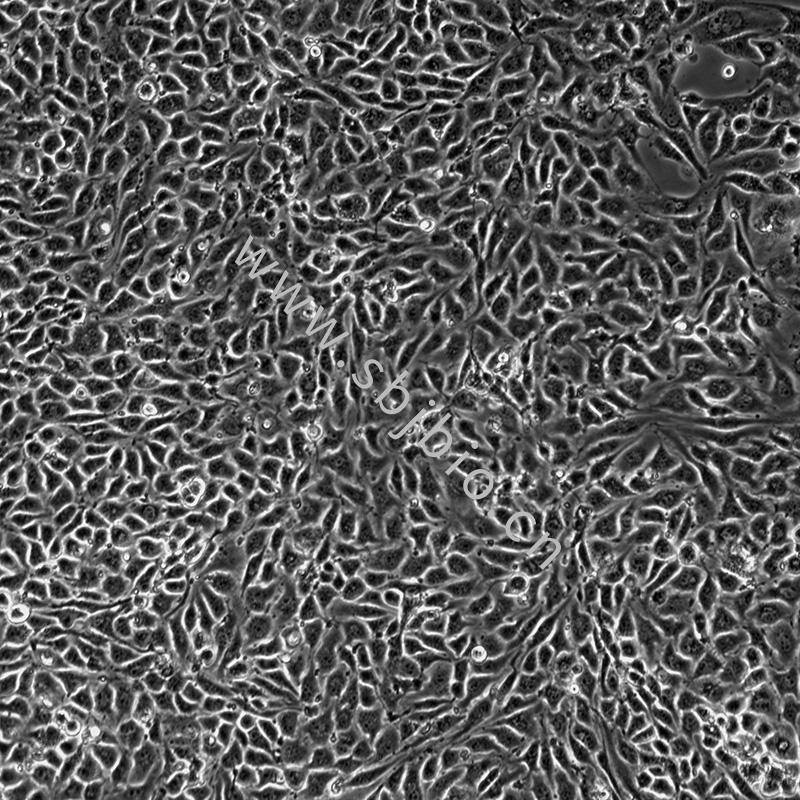 小鼠主动脉内皮细胞MAEC