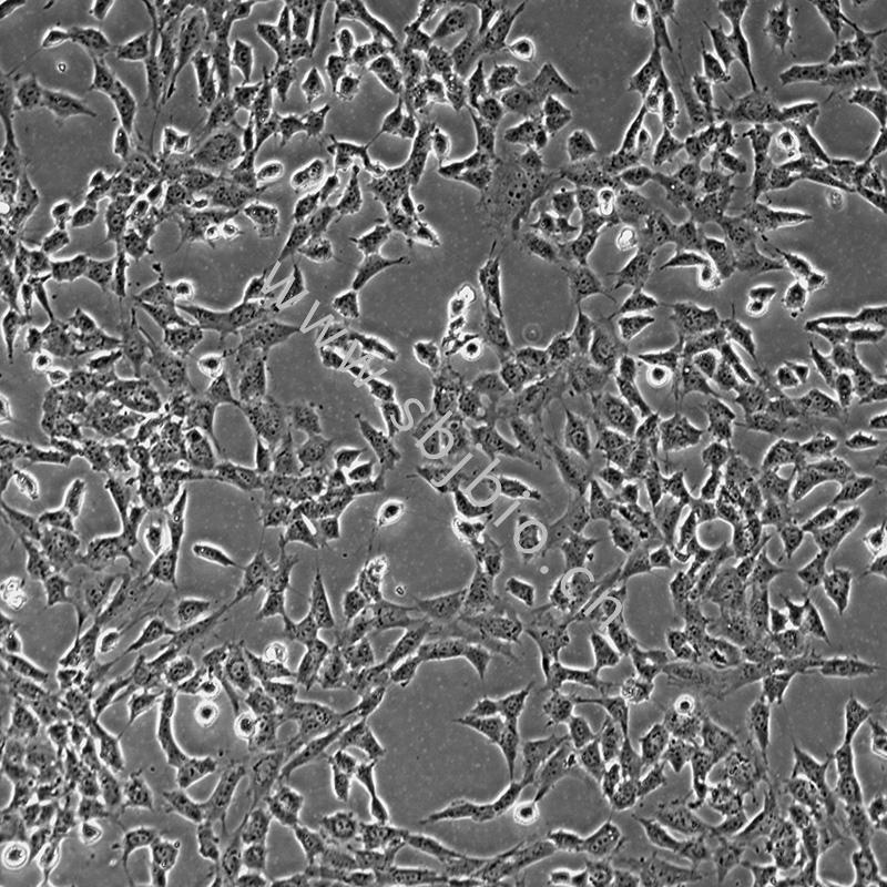 小鼠睾丸间质细胞TM3