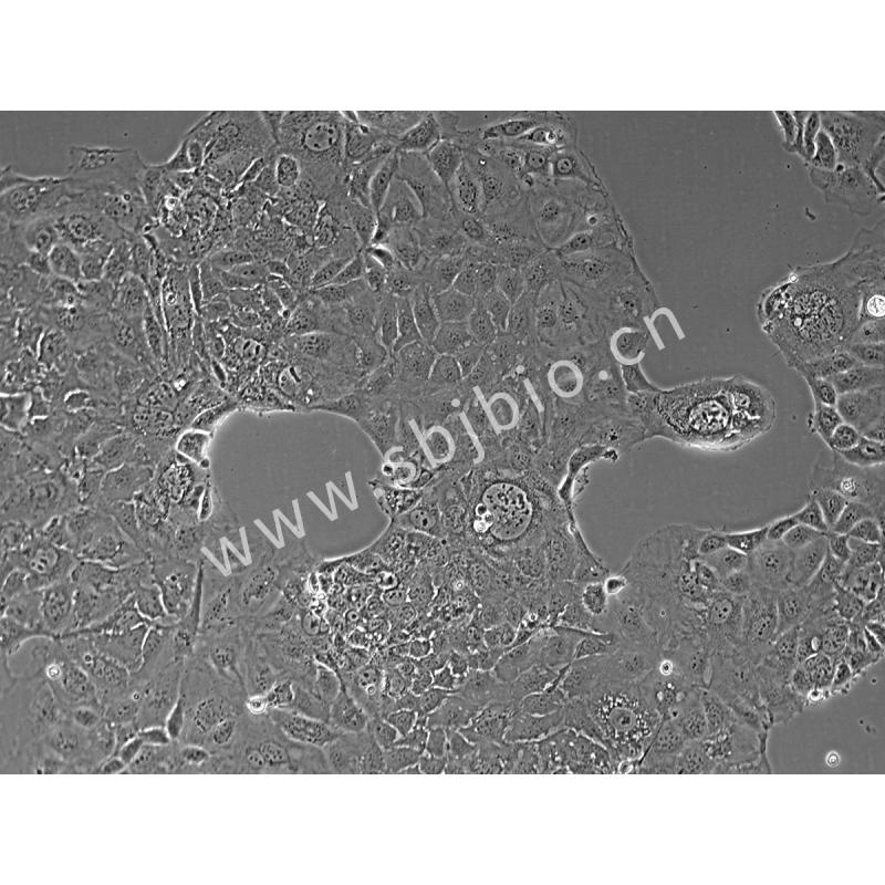 人结直肠腺癌细胞（Caco-2...