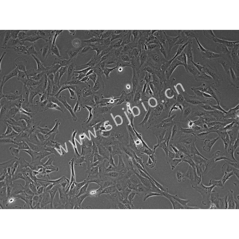 人正常肺上皮细胞(Beas-2B)