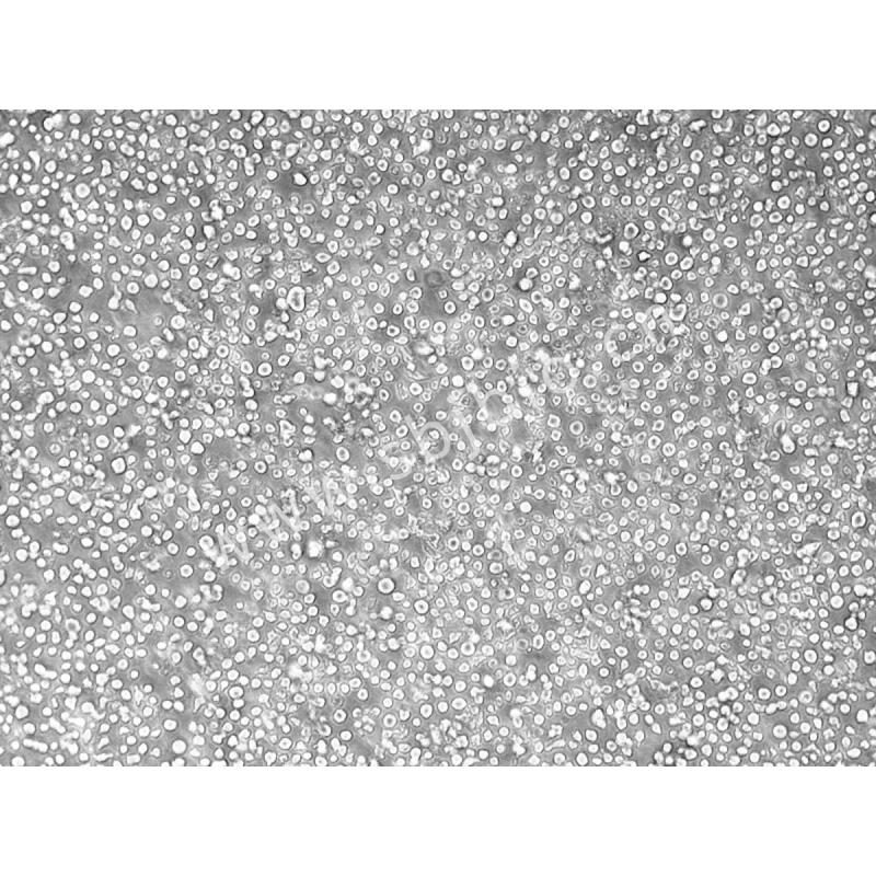 人组织细胞淋巴瘤细胞 （U-9...