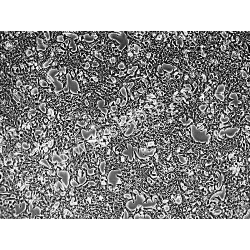 大鼠胰岛细胞瘤细胞 （INS-...